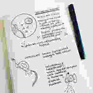 Mistaken Identity - T-cells attacking a joint