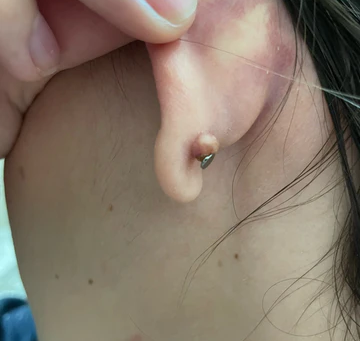 "How the No Pull Piercing Disc Can Help You Get Rid of Piercing Pumps"