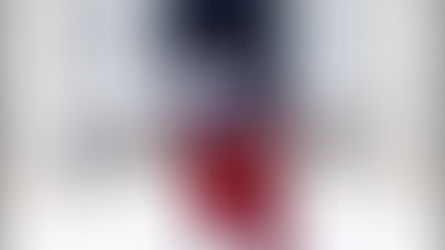 El Papa Francisco fue operado con éxito de un problema en el colon