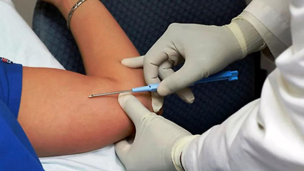 Salud Pública realiza la colocación de implantes subdérmicos