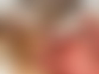 Un nuevo caso de remisión del VIH tras un trasplante de médula ósea