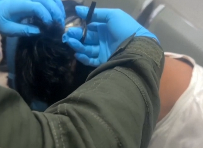 Man arrested trying to smuggle cocaine under toupee