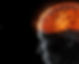 epilepsy-vs-seizure_edited.jpg