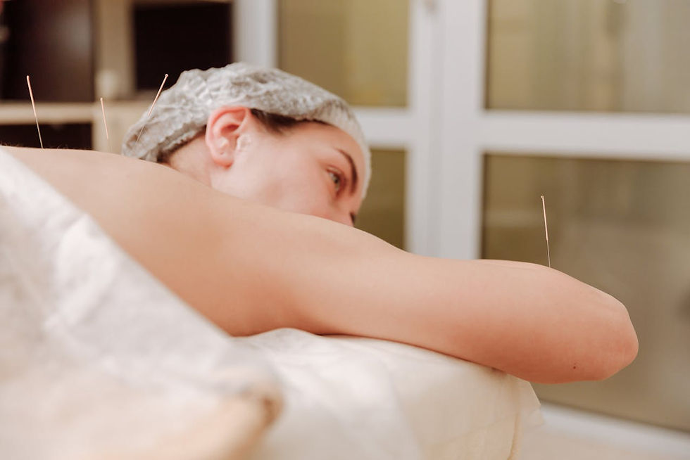 acupuncture.jpg