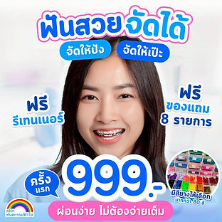 จัดฟันระยอง ไม่แพง ผ่อนได้