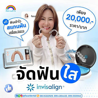 จัดฟันใสระยv' จัดฟันรอบ2