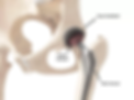 cadera.png