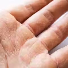 Skin-Concern-Calloused-Hands_cd028d1e-cd2e-439b-b454-43412305a9cf.avif