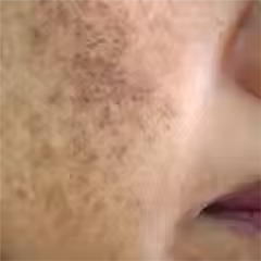 Skin-Concern-Pigmentation_3806e927-6ee9-4757-a9f5-456167047b5d.avif