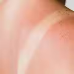 Skin-Concern-Sunburn_0dea0e81-cf6c-4d48-859f-71a95edcd039 (1).avif
