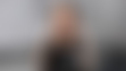 Migraña vestibular | Diagnóstico y tratamiento