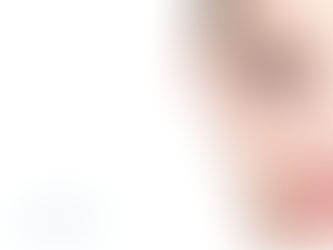 Mujer mira de frente que se realizó una rinoseptoplastia con el Dr. Danilo Mantilla