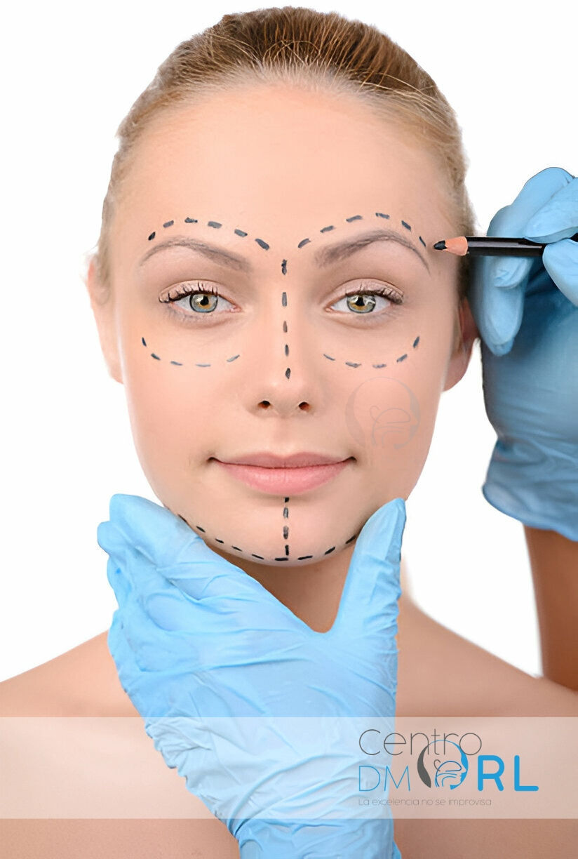 Marcador facial para cirugía estética, Danilo Mantilla ORL