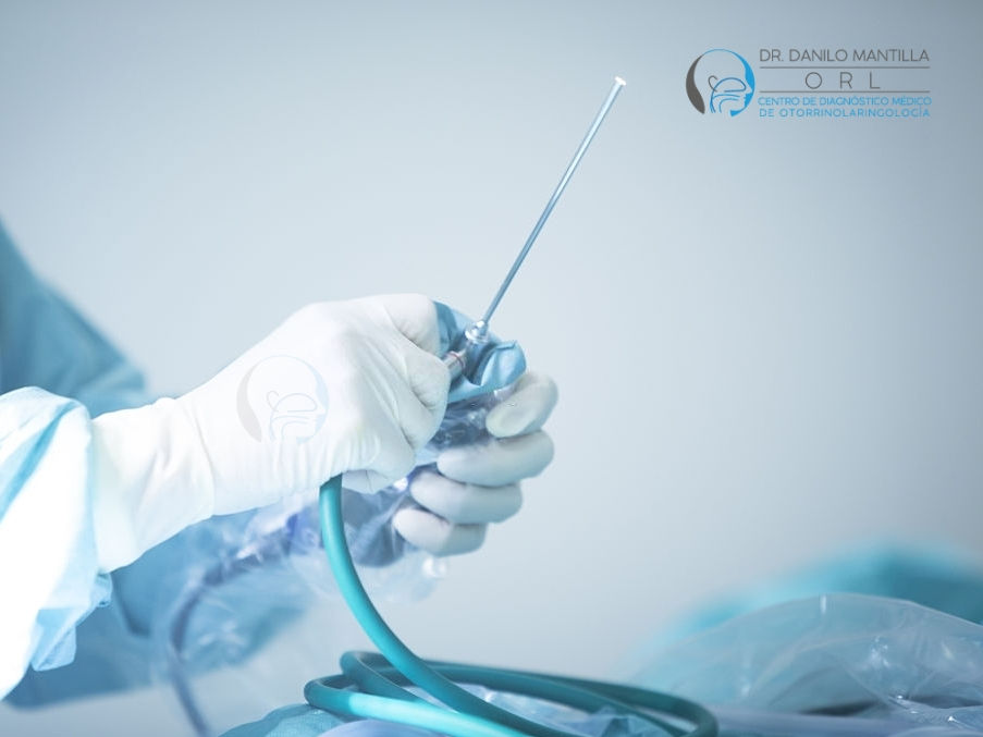 Equipo de Otoendoscopia del Dr. Danilo Mantilla