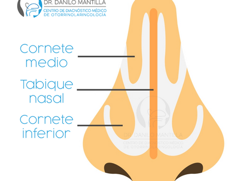 Cirugía de cornetes | Turbinoplastia | Hipertrofia de cornetes  