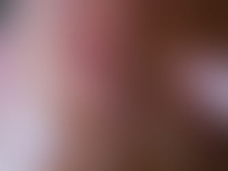 Scars: How our wounds make us who we are