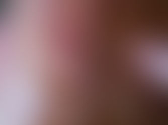 Scars: How our wounds make us who we are