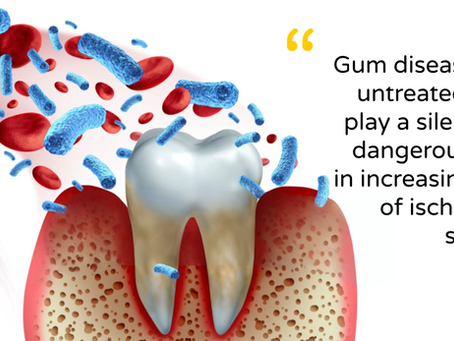 Why Bleeding Gums Might Be a Warning Sign for Stroke Risk