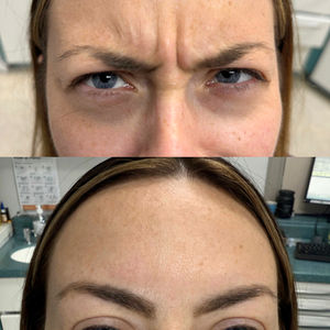 Before & After Cosmetic Work