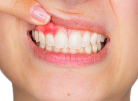 Think your gums are a lost cause?
