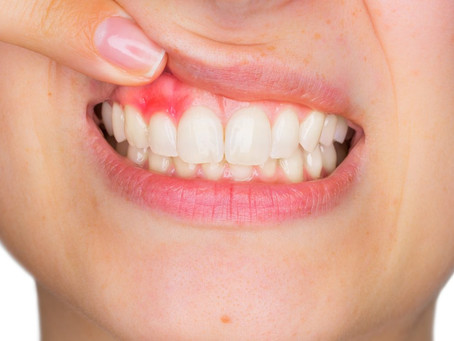 Think your gums are a lost cause?