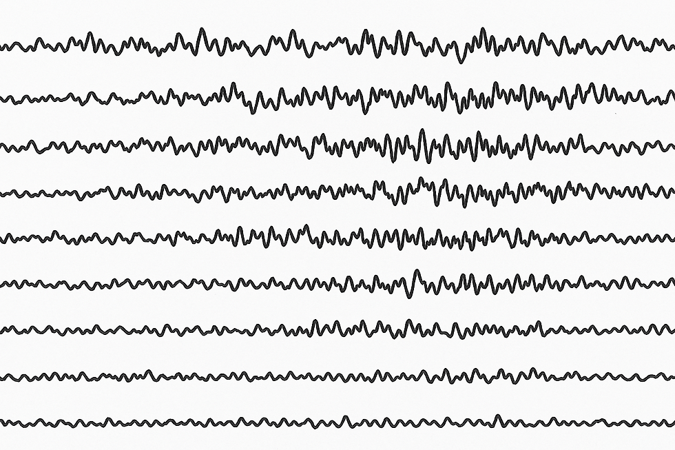 SAB, TBI, Status epilepticus und Organspende