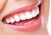 Importancia de la higiene bucal y asistir al dentista