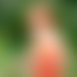 Pimple Positivity + Self-Love