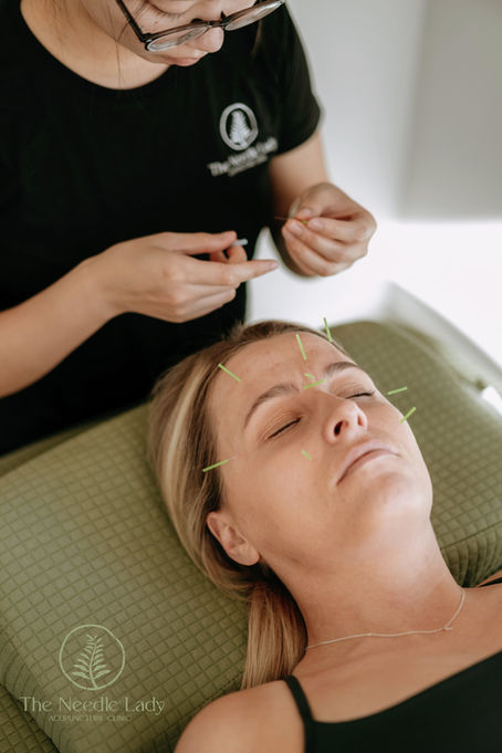 Reawaken Your Natural Glow:The Benefits of Cosmetic Acupuncture