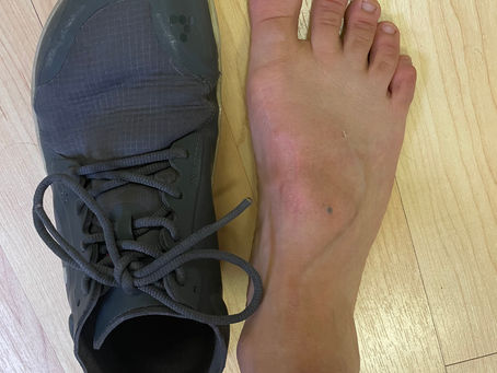 Tips to build healthier feet Part 1: Shoe Width