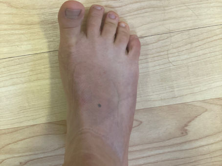 Foot Health Part 2: Foot Strength