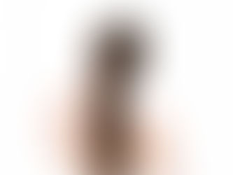 首から背中の痛み、左側の腕までしびれを伴う頸椎症で悩んでおられた50代女性の方