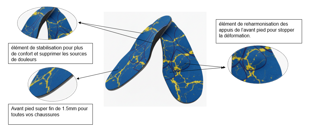 zoom detaille pour hv.PNG