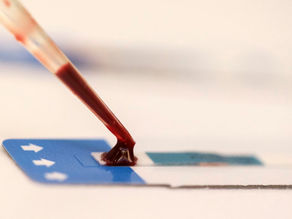 Metrô de São Paulo faz ação de combate ao HIV