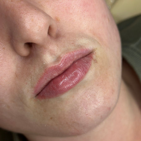 Healed Lip Blush