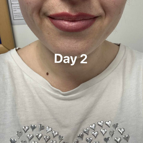 Day 2 lip blush