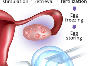 Egg Freezing in Your 20s? What You Need to Know Before You Decide