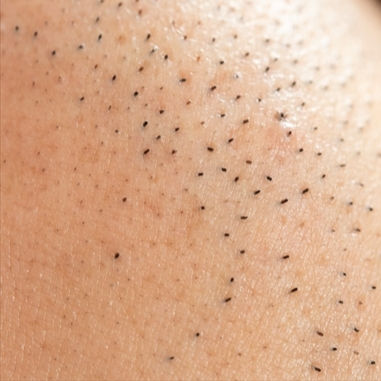 Close-up of calloused skin