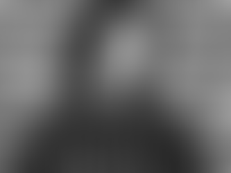 Travis Barker revela estar passando por problema de saúde