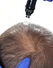haare.jpg