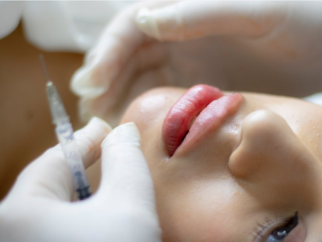 The Benefits of Laser Hair Removal in Kristiansand