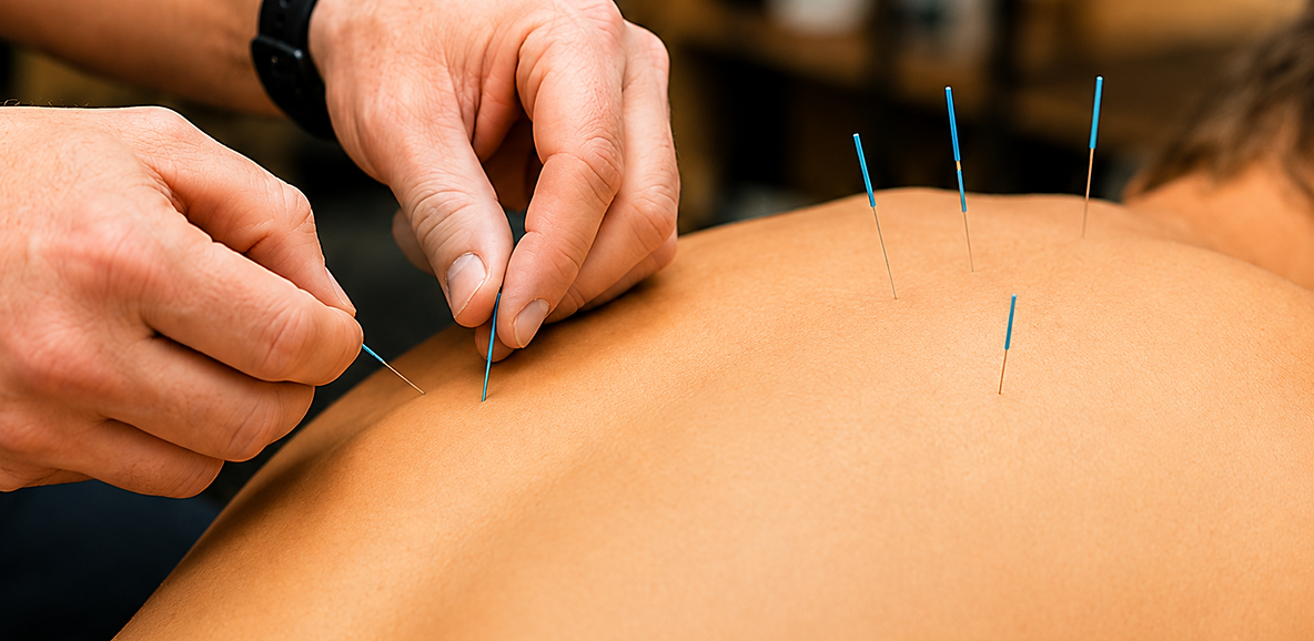 banner image dry needling.png