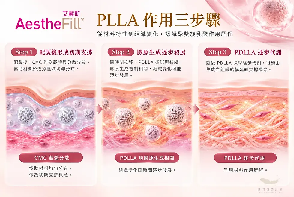 恩羽醫美 AestheFill 艾麗斯 PDLLA 作用三步驟示意