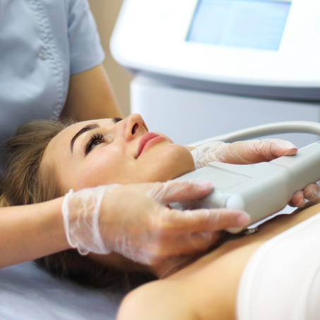 HIFU: el lifting facial sin cirugía.