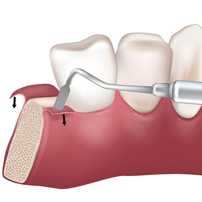 best dentist in hsr layout