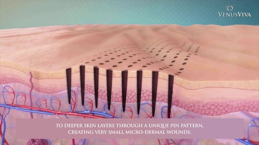 Thumbnail: VENUS VIVA MD