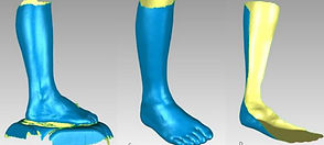 6. Additive manufacturing of specific ankle-food orthoses.jpg