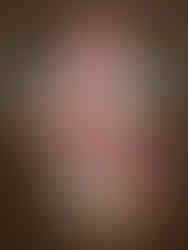 Exposition  Philippe KATERINE, Lunel