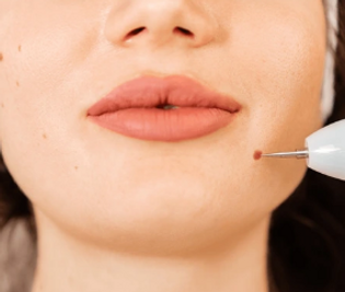 Best beauty treatments and services in Dundee, Aberdeen, and Stirling