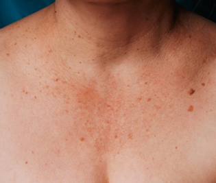 Best beauty treatments and services in Dundee, Aberdeen, and Stirling